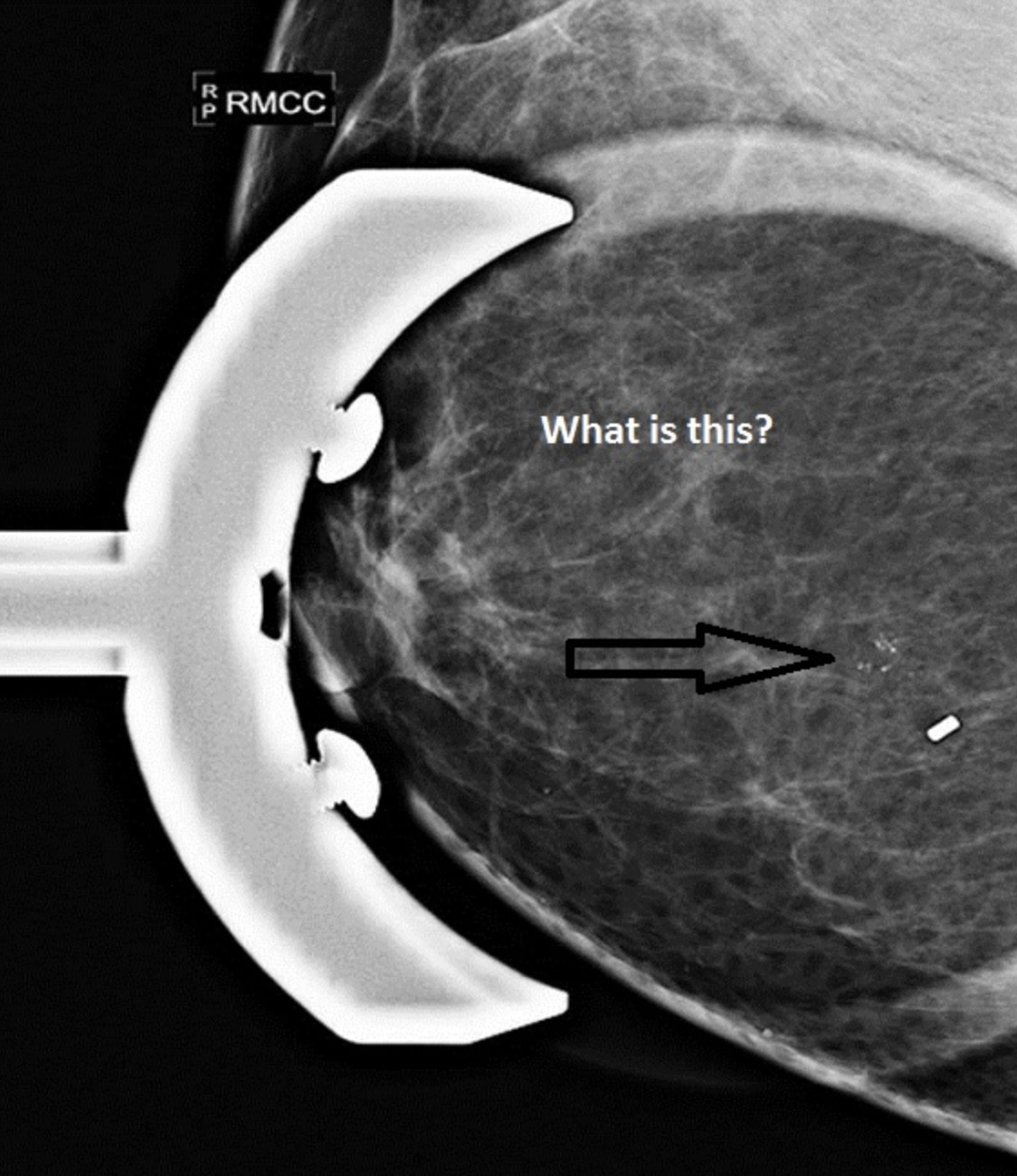 Mammography Certification Course - ARRT Exam CEUs - MammoTutor