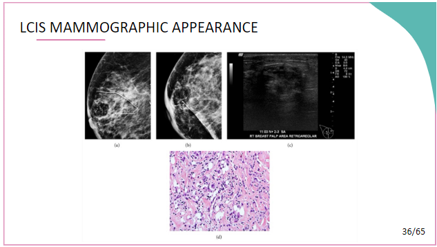 Mammography Certification Course - ARRT Exam CEUs - MammoTutor